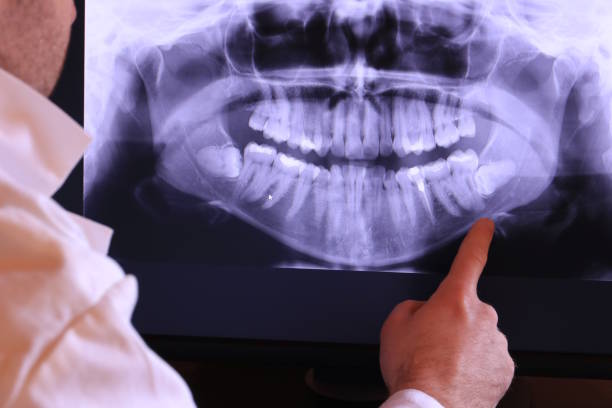 Best Emergency Root Canal Treatment in Edneyville, NC