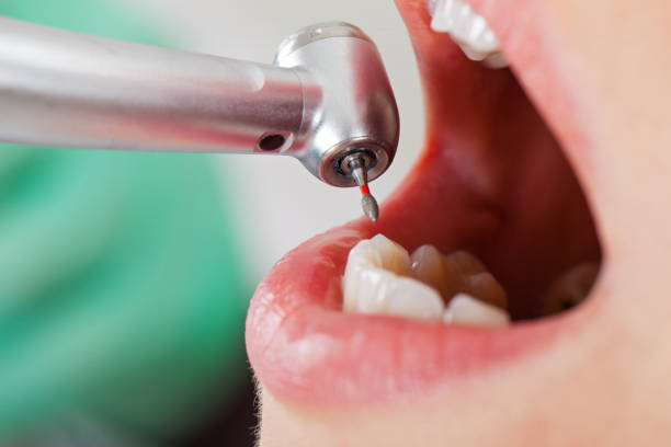 Best Emergency Treatment for Toothache in Edneyville, NC
